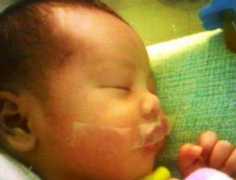Nurse Taped Newborn Baby’s Mouth Shut To Stop From Crying