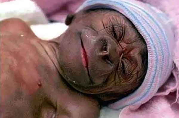 First Humanzee (Chimpanzee/Human Hybrid) Born In Nigeria