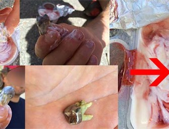 Man Finds Tooth In Whole Foods Yogurt